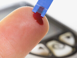 Bild zu Blutzuckermessung - Glucoseoxidase-based Blood Glucose Test Strips