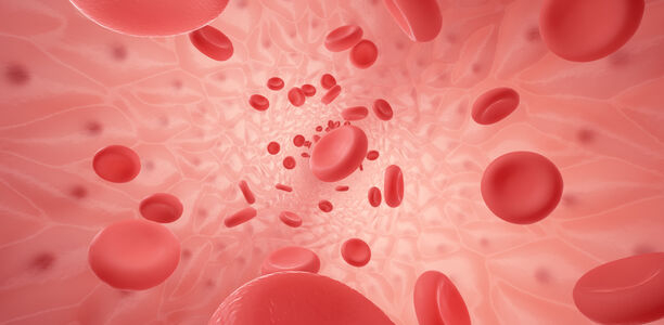 Bild zu Adipositas und DM Typ 2  - DFG-Projekt untersucht wie Blutgefäße sich verändern