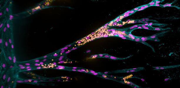 Bild zu Zellkultursystem - Erstes künstliches Gewebemodell, in dem Blutgefäße wachsen