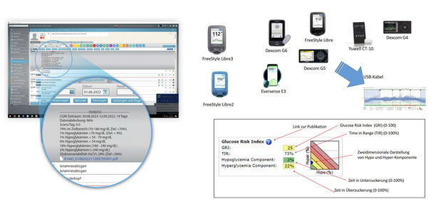 Bild zu DIABASS - Einlesen von rtCGM ohne Cloud 